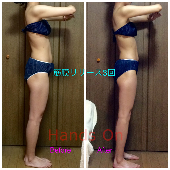 筋膜リリースの効果2