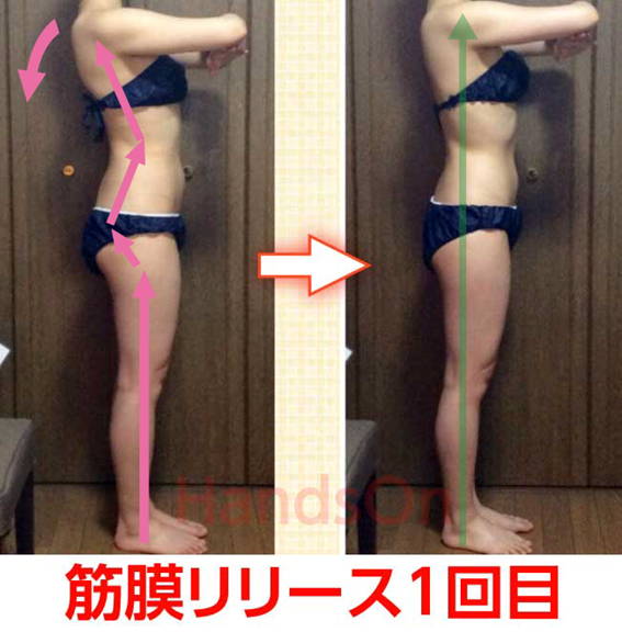 筋膜リリースの効果1